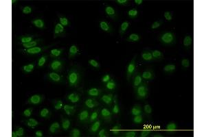 Immunofluorescence of monoclonal antibody to STK17B on HeLa cell. (DRAK2 抗体  (AA 272-372))