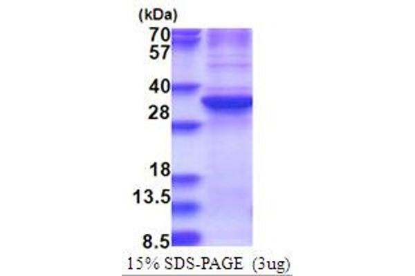 ZNF32 Protein (AA 1-273) (His tag)