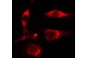 ABIN6276876 staining  HeLa cells by IF/ICC.
