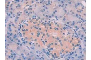 Immunohistochemistry (IHC) image for anti-Stanniocalcin 1 (STC1) (AA 28-247) antibody (ABIN7435202)