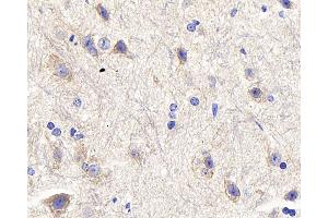 Immunohistochemistry analysis of paraffin-embedded mouse spinal marrow using DLL3 Polyclonal Antibody at dilution of 1:300. (DLL3 抗体)