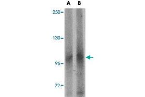 Western blot analysis of LRFN1 in human brain tissue lysate with LRFN1 polyclonal antibody  at (A) 1 and (B) 2 ug/mL . (LRFN1 抗体  (C-Term))
