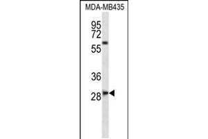 Western blot analysis in MDA-MB435 cell line lysates (35ug/lane). (SLAMF8 抗体  (C-Term))