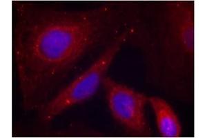 Image no. 3 for anti-P21-Activated Kinase 1 (PAK1) (pThr212) antibody (ABIN196879) (PAK1 抗体  (pThr212))