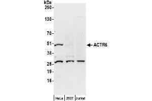 anti-ARP6 Actin-Related Protein 6 Homolog (ACTR6) (AA 1-50) antibody
