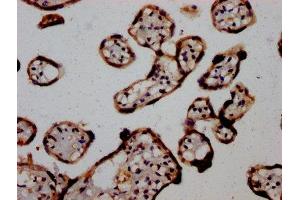 Immunohistochemistry (IHC) image for anti-Argonaute 2 (AGO2) (AA 517-818) antibody (ABIN7165091)