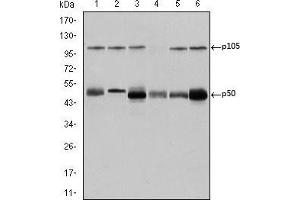 Western blot analysis using NFKB1 mouse mAb against K562 (1), Jurkat (2), A431 (3), Hela (4), THP-1 (5) and MCF-7 (6) cell lysate.