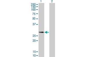 Western Blot analysis of SLA2 expression in transfected 293T cell line by SLA2 monoclonal antibody (M01), clone 3G5. (SLAP2 抗体  (AA 1-261))