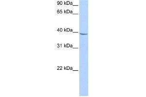 WB Suggested Anti-NUDT17 Antibody Titration:  0.