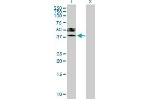 Western Blot analysis of ST6GALNAC6 expression in transfected 293T cell line by ST6GALNAC6 MaxPab polyclonal antibody. (ST6GALNAC6 抗体  (AA 1-333))