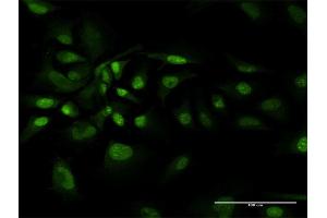 Immunofluorescence of purified MaxPab antibody to BAG1 on HeLa cell. (BAG1 抗体  (AA 1-274))