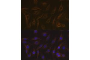 Immunofluorescence analysis of C6 cells using EB3/M Rabbit mAb (ABIN7268535) at dilution of 1:100 (40x lens). (MAPRE3 抗体)