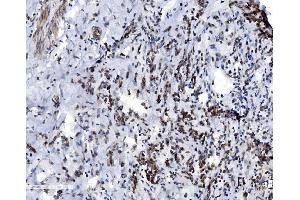 IHC analysis of VDAC3 using anti-VDAC3 antibody (ABIN7602541).