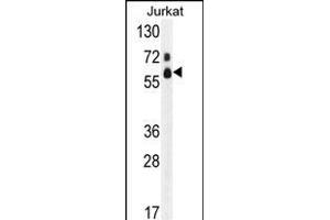 Western blot analysis of hFASTK- (ABIN391120 and ABIN2841247) in Jurkat cell line lysates (35 μg/lane). (FASTK 抗体  (C-Term))