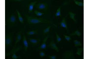 Image no. 3 for anti-Aldehyde Dehydrogenase 1 Family, Member L1 (ALDH1L1) antibody (ABIN1496581) (ALDH1L1 抗体)