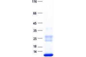 Western Blotting (WB) image for Blocked Early in Transport 1 Homolog (BET1) protein (His tag) (ABIN5505564)
