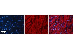 Rabbit Anti-AKR1C3 Antibody Catalog Number: ARP61430_P050 Formalin Fixed Paraffin Embedded Tissue: Human heart Tissue Observed Staining: Cytoplasmic Primary Antibody Concentration: 1:100 Other Working Concentrations: N/A Secondary Antibody: Donkey anti-Rabbit-Cy3 Secondary Antibody Concentration: 1:200 Magnification: 20X Exposure Time: 0. (AKR1C3 抗体  (N-Term))
