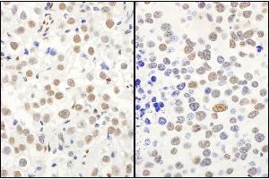 Immunohistochemistry (IHC) image for anti-Protein Quaking (QKI) (C-Term), (Isoform 5) antibody (ABIN7454593) (QKI 抗体  (C-Term, Isoform 5))
