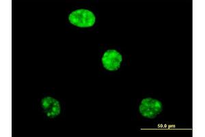 Immunofluorescence of purified MaxPab antibody to ADAR on HeLa cell. (ADAR 抗体  (AA 1-1226))