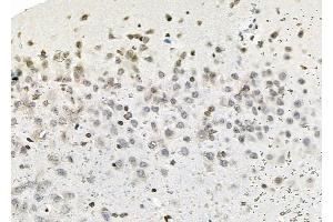 ABIN6263687 and ABIN6279632 at 1/100 staining Rat brain tissue by IHC-P. (NOL7 抗体  (C-Term))