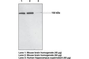 Image no. 1 for anti-PH Domain and Leucine Rich Repeat Protein Phosphatase 1 (PHLPP1) antibody (ABIN2451738)