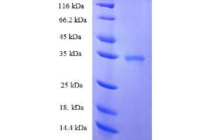 SDS-PAGE (SDS) image for Centrin, EF-Hand Protein, 2 (CETN2) (AA 1-172), (full length) protein (His-SUMO Tag) (ABIN5709277)