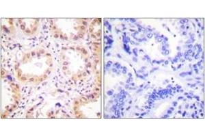 Immunohistochemistry (IHC) image for anti-Neural Precursor Cell Expressed, Developmentally Down-Regulated 8 (NEDD8) (AA 10-59) antibody (ABIN1533430)