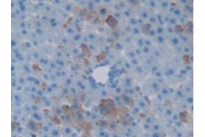 Detection of HSPBP1 in Rat Liver Tissue using Polyclonal Antibody to Heat Shock 70 kDa Binding Protein 1 (HSPBP1)