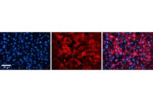 Rabbit Anti-EIF4G2 Antibody   Formalin Fixed Paraffin Embedded Tissue: Human Liver Tissue Observed Staining: Cytoplasm in hepatocytes Primary Antibody Concentration: N/A Other Working Concentrations: 1:600 Secondary Antibody: Donkey anti-Rabbit-Cy3 Secondary Antibody Concentration: 1:200 Magnification: 20X Exposure Time: 0. (EIF4G2 抗体  (C-Term))
