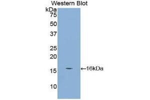 Detection of Recombinant CUBN, Mouse using Polyclonal Antibody to Cubilin (CUBN) (CUBN 抗体  (AA 3157-3274))
