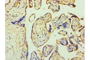 Immunohistochemistry (IHC) image for anti-Zinc Finger Protein 346 (ZNF346) (AA 1-294) antibody (ABIN7176253)