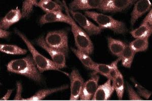 Immunofluorescent staining of HeLa cells. (PRKACA 抗体  (AA 18-347))