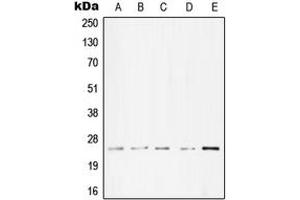 Western blot analysis of cTnI expression in A431 (A), Molt4 (B), A549 (C), NIH3T3 (D), PC12 (E) whole cell lysates. (TNNI3 抗体  (Center))