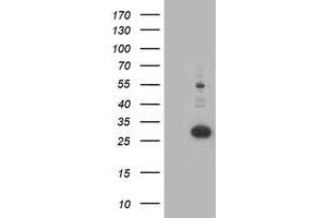 Western Blotting (WB) image for anti-Pyridoxamine 5'-Phosphate Oxidase (PNPO) antibody (ABIN1500319) (PNPO 抗体)
