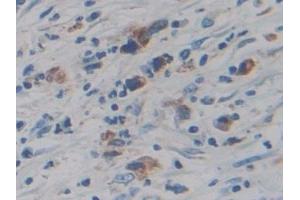 Immunohistochemistry (IHC) image for anti-Cytochrome P450, Family 21, Subfamily A, Polypeptide 2 (CYP21A2) (AA 106-389) antibody (ABIN7441886)