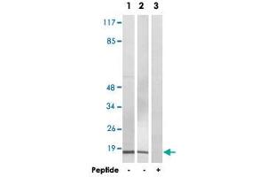 Western blot analysis of extracts from COLO 205 cells (Lane 1 and lane 3) and HeLa cells (Lane 2), using BRP44L polyclonal antibody . (BRP44L 抗体  (Internal Region))