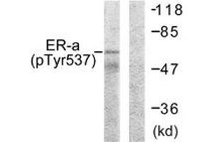 Western blot analysis of extracts from 293 cells, using Estrogen Receptor-alpha (Phospho-Tyr537) Antibody. (Estrogen Receptor alpha 抗体  (pTyr537))