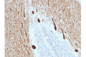 Formalin-fixed, paraffin-embedded human Cerebellum stained with CA8 Mouse Monoclonal Antibody (CPTC-CA8-2).
