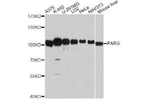 Western blot analysis of extracts of various cell lines, using PARG antibody. (PARG 抗体  (AA 777-976))