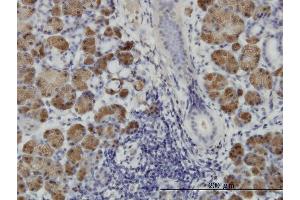 Immunoperoxidase of monoclonal antibody to HIPK1 on formalin-fixed paraffin-embedded human salivary gland. (HIPK1 抗体  (AA 330-430))