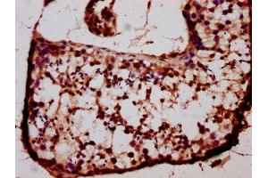 IHC image of ABIN7145250 diluted at 1:400 and staining in paraffin-embedded human testis tissue performed on a Leica BondTM system. (BARHL1 抗体  (AA 38-176))