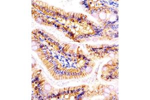 (ABIN6242231 and ABIN6578095) staining (Mouse) Epcam in mouse colon sections by Immunohistochemistry (IHC-P - paraformaldehyde-fixed, paraffin-embedded sections). (EpCAM 抗体  (C-Term))