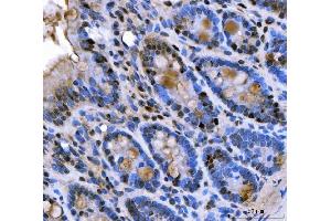 IHC analysis of U1A/SNRPA using anti-U1A/SNRPA antibody (ABIN7600891). (SNRPA1 抗体  (AA 25-218))