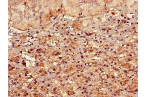 Immunohistochemistry of paraffin-embedded human adrenal gland tissue using ABIN7167713 at dilution of 1:100 (RMND1 抗体  (AA 35-160))