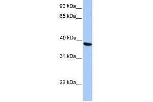 WB Suggested Anti-NAT6 Antibody Titration:  0.