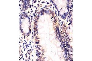 Immunohistochemistry (Paraffin-embedded Sections) (IHC (p)) image for anti-SRY (Sex Determining Region Y)-Box 10 (SOX10) (AA 231-259) antibody (ABIN652035)