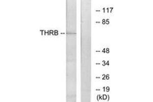 Western blot analysis of extracts from NIH-3T3 cells, using THRB Antibody. (THRB 抗体  (AA 391-440))