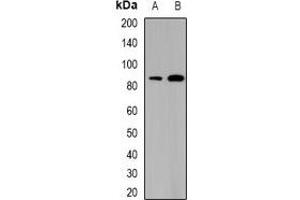 Western blot analysis of SATB1 expression in THP1 (A), mouse thymus (B) whole cell lysates. (SATB1 抗体)