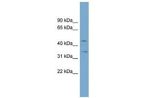 SLC39A8 antibody used at 1 ug/ml to detect target protein. (SLC39A8 抗体)