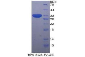 SDS-PAGE analysis of Human STAT1 Protein. (STAT1 蛋白)